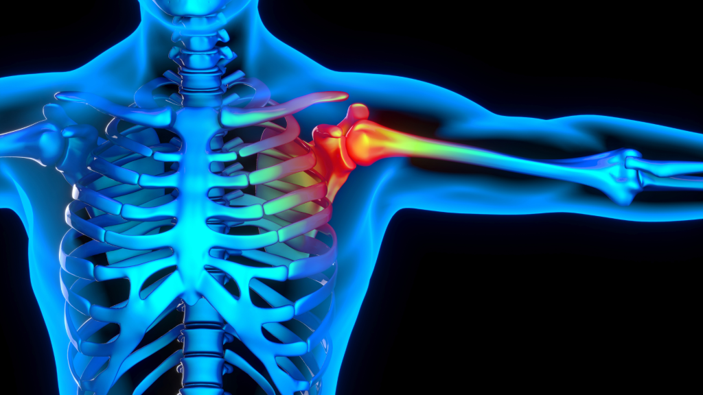 Navigating the “Frozen” Phase of Frozen Shoulder: What to Expect & How to Stay Positive